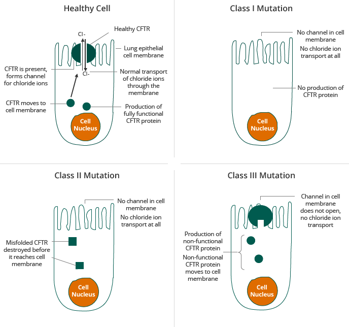 CF Mutations from healthy cell to Class III Mutation (illustration)